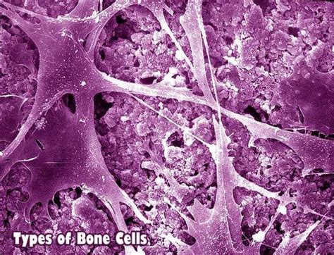 a mature bone cell trapped in bone matrix